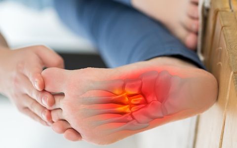 Heel Spur