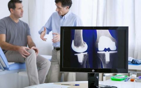 Understanding Total Knee Replacement Surgery